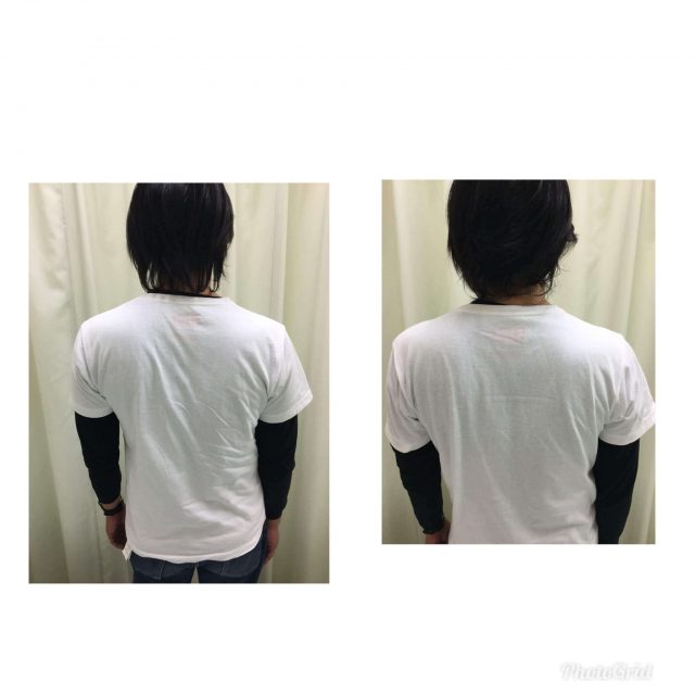 背部の痛みがあるお客様